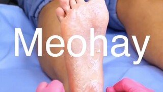 Mẹo hay không bỏ phí