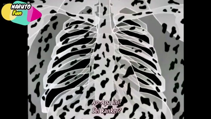 Naruto Funny Moment || Dalam Tubuh Shino