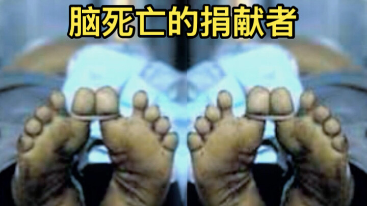 Pernahkah kamu mendengar tentang dua pendonor yang mengalami kematian otak ini?