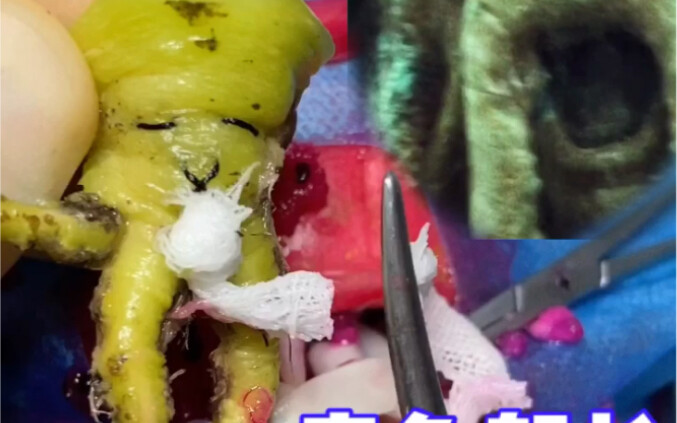 Ca mổ lấy thai của Thuyền trưởng Bạch tuộc! Hành trình ra đời của Davy Jones!