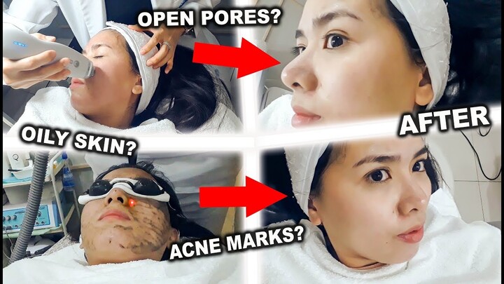 Pano Magpaliit ng Pores?