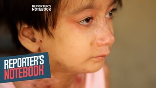 Batang may 'Butterfly Disease,' tinitiis ang sakit para lang makapag-aral | Reporter’s Notebook
