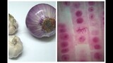 Mitosis in Onion Root tip Experiment