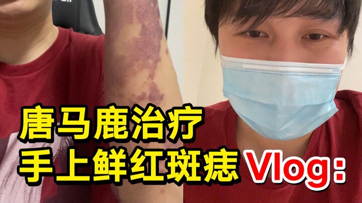 Ai hỏi tay tôi bị sao thì xem đây!