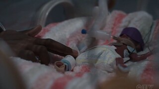 【The Good Doctor】A premature baby born at just 24 weeks is so tiny and fragile—it's really heartbrea