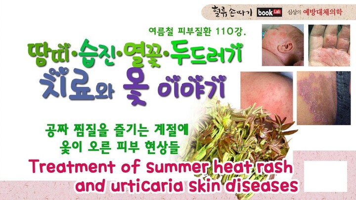 피부병. 110강. 여름철 땀띠,열꽃,습진의 원인과 치료. 항염 옻 이야기. Treatment of summer heat rash and urticaria skin diseases