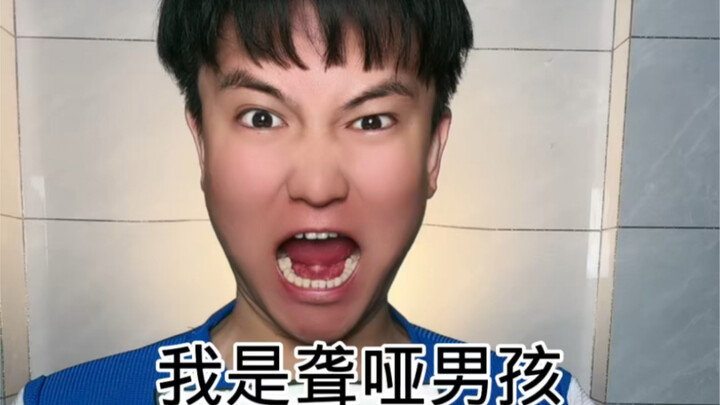 Saya adalah seorang anak laki-laki tuli dan bisu, kalian mau makan kentang goreng nggak?