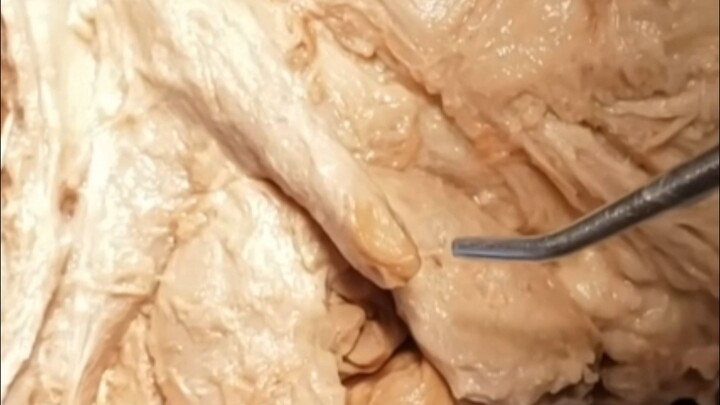 Klitoris perempuan memiliki panjang sekitar 7-9 cm, dan terdiri dari tiga bagian (pengetahuan umum, 