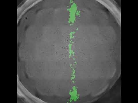 Scratch Assay: Kinetic analysis of in vitro wound closure by keratinocytes