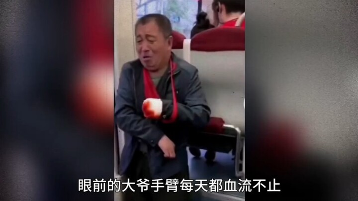 The “amputee” man reappears at the subway station, his professional act moves everyone!