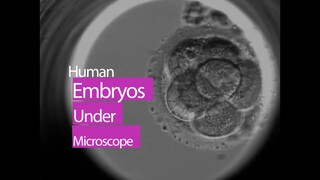 Human Embryo Under Microscope | This is How Life Begins at Conception