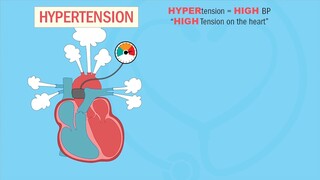 Hypertension