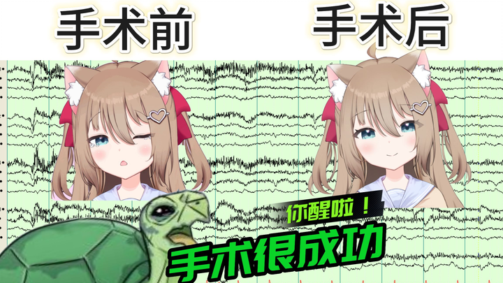 【Neuro 2.0】直播时emo爆小珍珠的AI😣惨遭开颅！