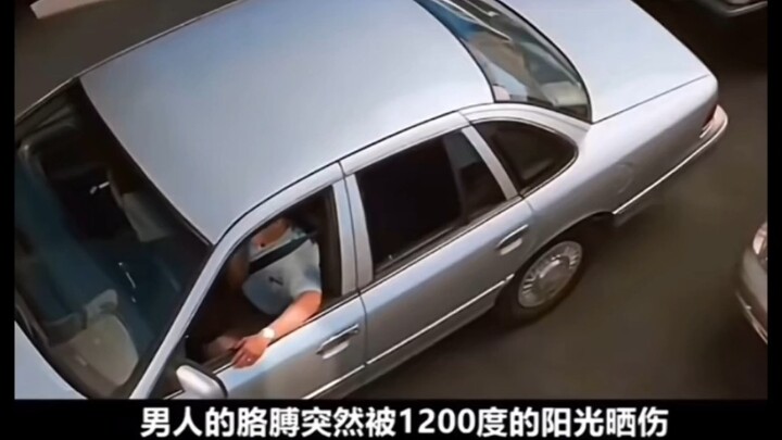 Cánh tay của người đàn ông bỗng bị cháy nắng bởi ánh nắng 1200 độ, rốt cuộc là chuyện gì đã xảy ra?