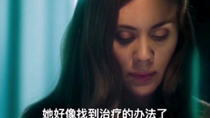 Bàn tay phụ nữ bị bong tróc nghiêm trọng, cách xử lý sẽ khiến bạn không thể ngờ tới