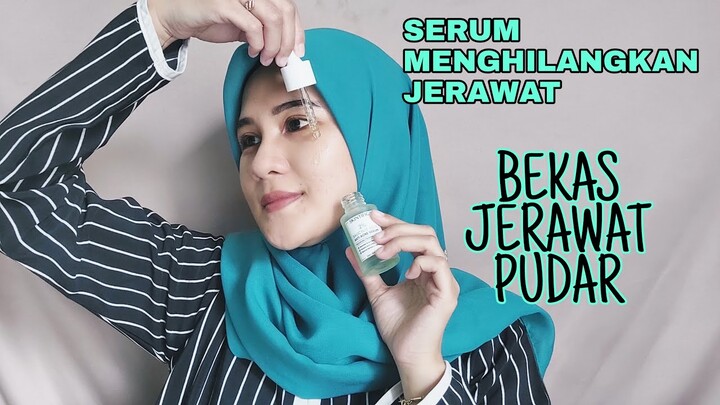 SERUM AMPUH UNTUK MENGHILANGKAN JERAWAT (SKINTIFIC) | Hesti Oktaviawati | Indonesia