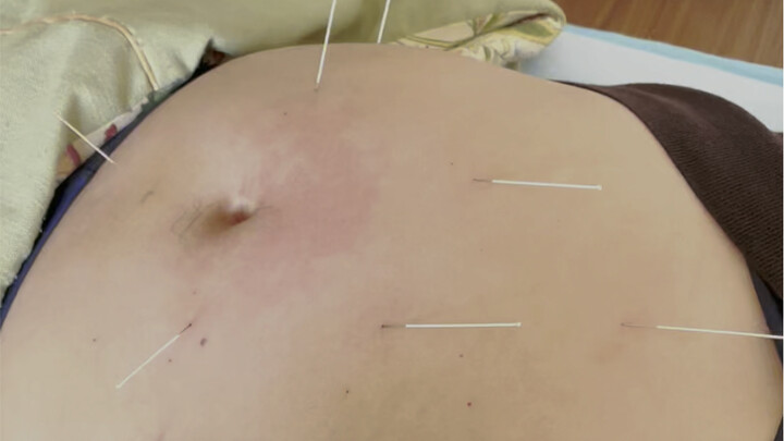 The Dangers of Obesity