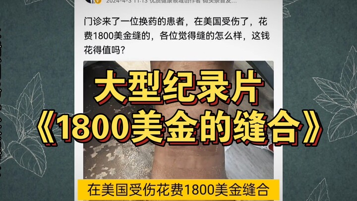 《1800美金的缝合》