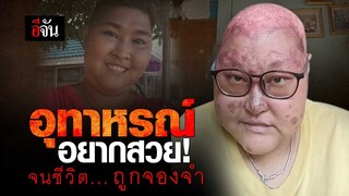 คลิปโซเชียล อุทาหรณ์ อยากสวย! จนชีวิต ถูกจองจำ | อีจัน EJAN