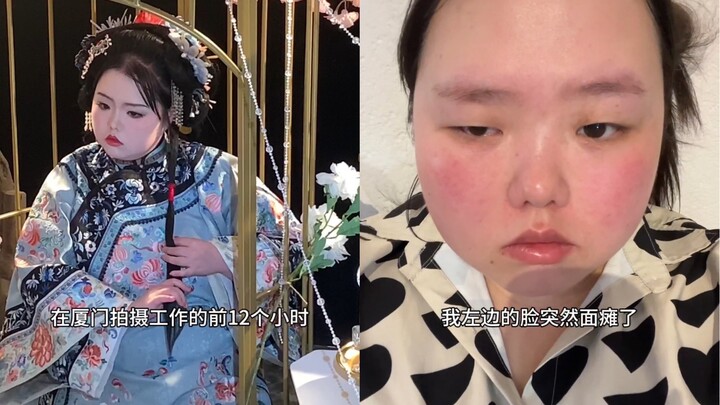 Kelumpuhan wajah itu menakutkan banget!! Semua orang jangan begadang lagi, ya!!