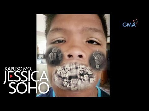 Kapuso Mo, Jessica Soho: Bata, may halos 200 piraso ng ngipin?!