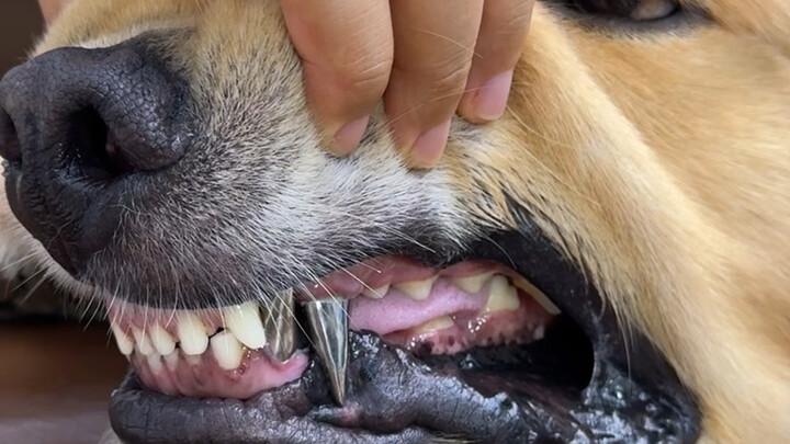 Sharing my experience of getting a titanium alloy crown fitted