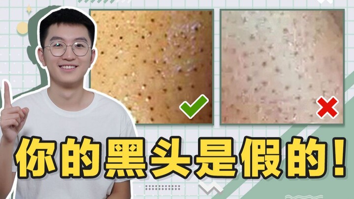 【รุ่นพี่มหาวิทยาลัยชิงหัว】เปิดเผยความจริงเรื่องสิวเสี้ยน! คุณยังไม่รู้เลยเหรอว่าสิวเสี้ยนของคุณเป็นข
