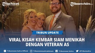 Viral Kisah Kembar Siam Abby Hensel Menikah dengan Veteran Josh Bowling, Dirahasiakan 2 Tahun