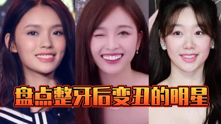 盘点整牙后变丑的明星