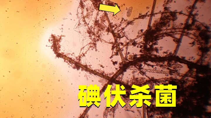 How powerful is povidone-iodine at killing bacteria? When observed under a microscope, something inc