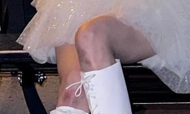 Winter rơi khỏi sân khấu nâng trong concert tại Sân vận động Tokyo Dome