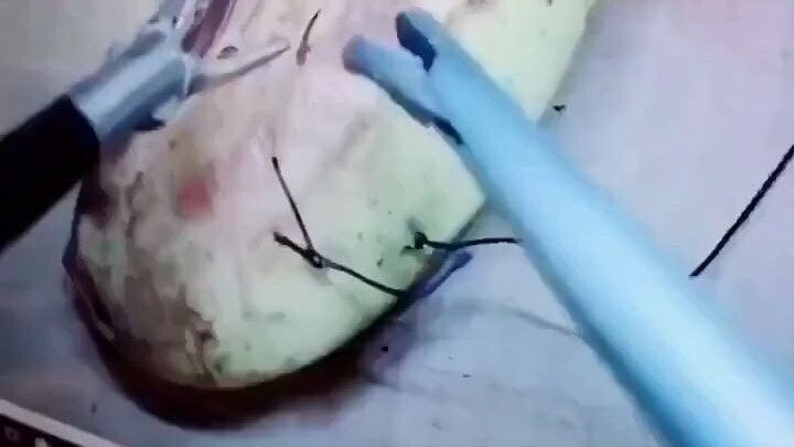 ความทุ่มเทในยามปกติ ก็เพื่อช่วยชีวิตในช่วงเวลาสำคัญ!