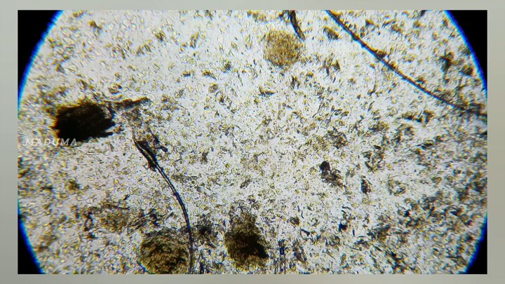 When Earwax Meets Water and Microscopic Movement