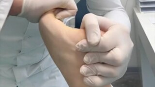 扁平足矫正（伪）