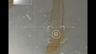 The macro lens of Huawei mate60pro directly shoots biological glass slides. The effect really surpri