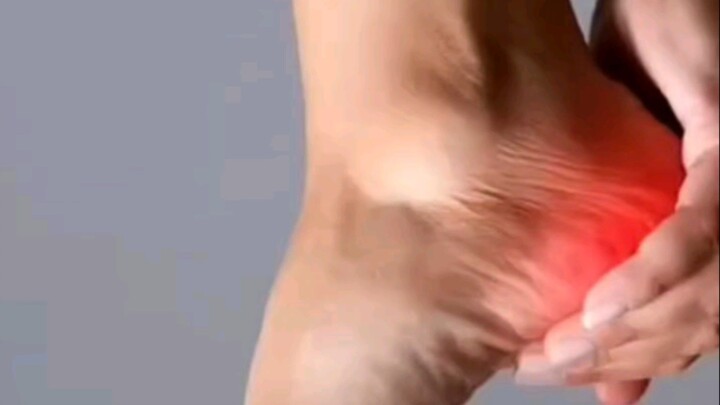 Heel pain relief exercise at home ✅