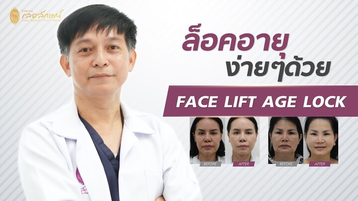 สวย สุข ศัลย์ Ep 7: ล็อคอายุ ง่ายๆด้วย FACE LIFT AGE LOCK (ดึงหน้า)