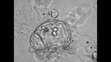 Anonymous 3D Organoid Time Lapse