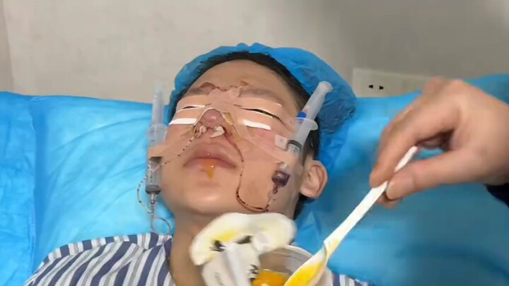 [Divine Master TV] To chase his idol, he had his son undergo plastic surgery to look like Zhang Ling