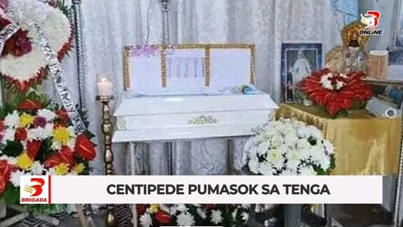 centipede pumasok sa tenga nang baby. 😢😢😢😢