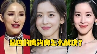 Mũi khoằm hung dữ phải giải quyết thế nào