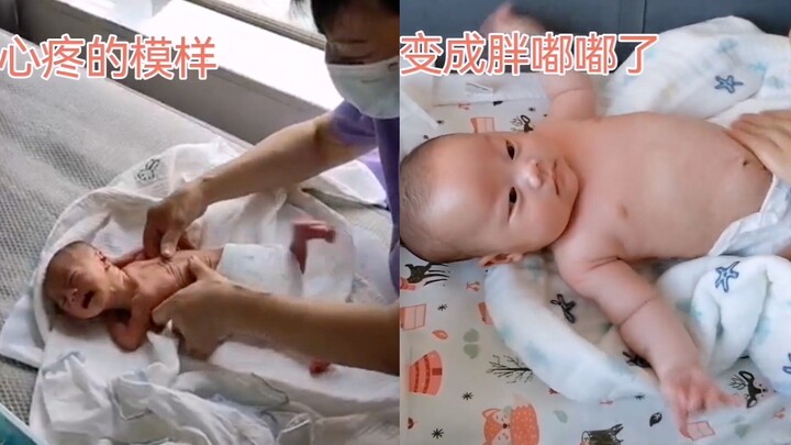 Bayi laki-laki lahir prematur dengan berat hanya 1,5 kg, tubuhnya kurus kering hingga tampak seperti