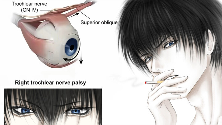 Strabismus meme × Hijikata Toshizo [B-Moe Support]
