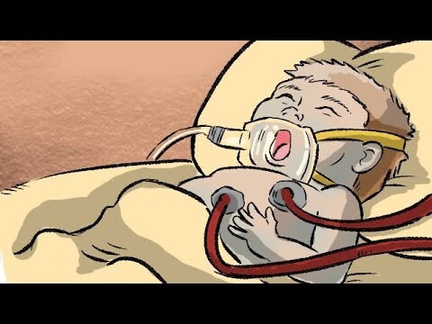 Hidupku Dengan Autisme