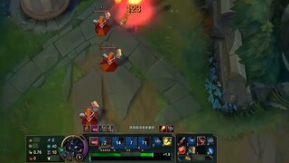 Playing on the road is all about human accidents!