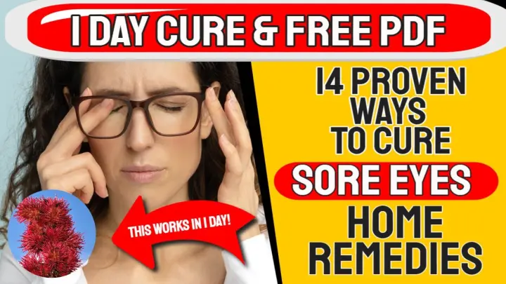 1 Day Cure With This Natural Oil 🧴 14 NATURAL REMEDY FOR SORE EYES 👁️ Natural Remedy For SORE EYES👁️