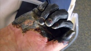 Мужчину укусил кот, когда на него взглянули врачи, то не поверили своим глазам