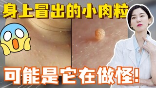 Benjolan kecil di tubuhmu mungkin disebabkan olehnya!