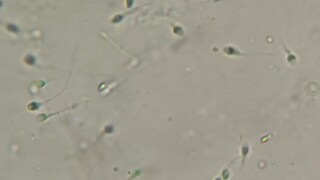 我就好奇小蝌蚪哪来的