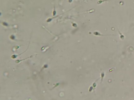 我就好奇小蝌蚪哪来的